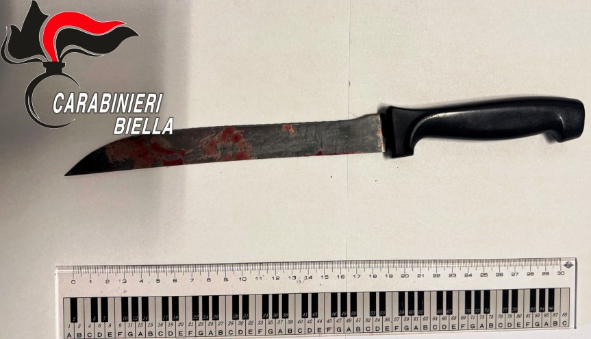 ACCOLTELLA UN CONOSCENTE PER FUTILI MOTIVI. ARRESTATO DAI CARABINIERI PER LESIONI PERSONALI&nbsp;AGGRAVATE